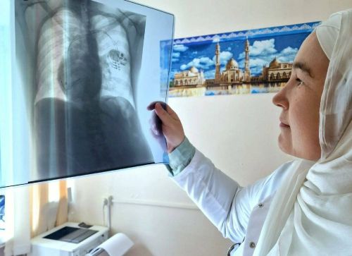 Чаллы табиблары йөрәге уң якта урнашкан пациентка ярдәм күрсәтте