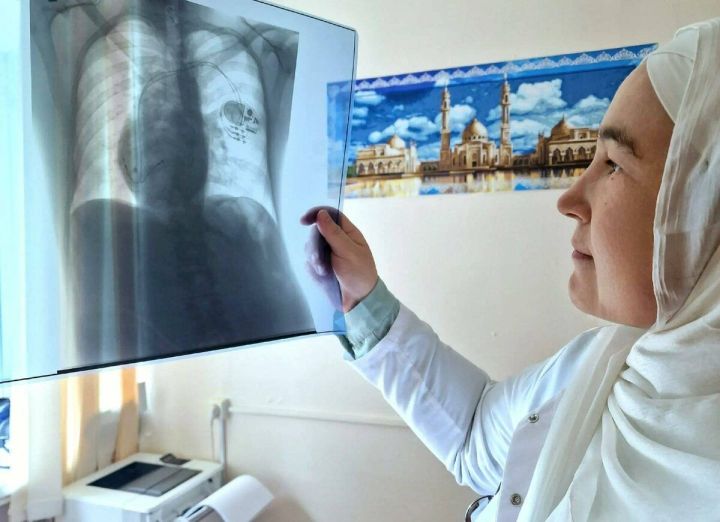 Чаллы табиблары йөрәге уң якта урнашкан пациентка ярдәм күрсәтте